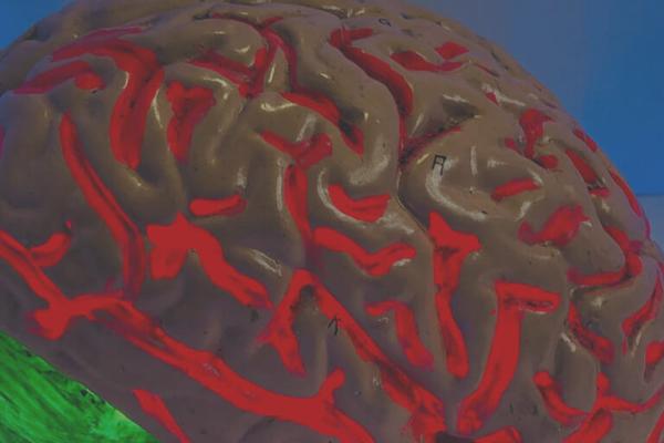 How Healthy Is Your Brain?